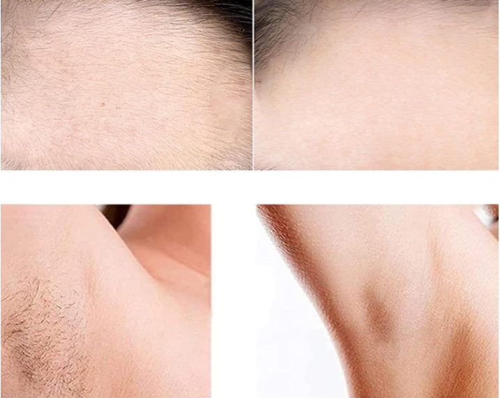 Épilateur électrique pour le visage et le corps