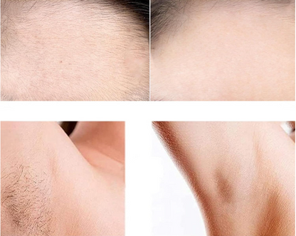 Épilateur électrique pour le visage et le corps